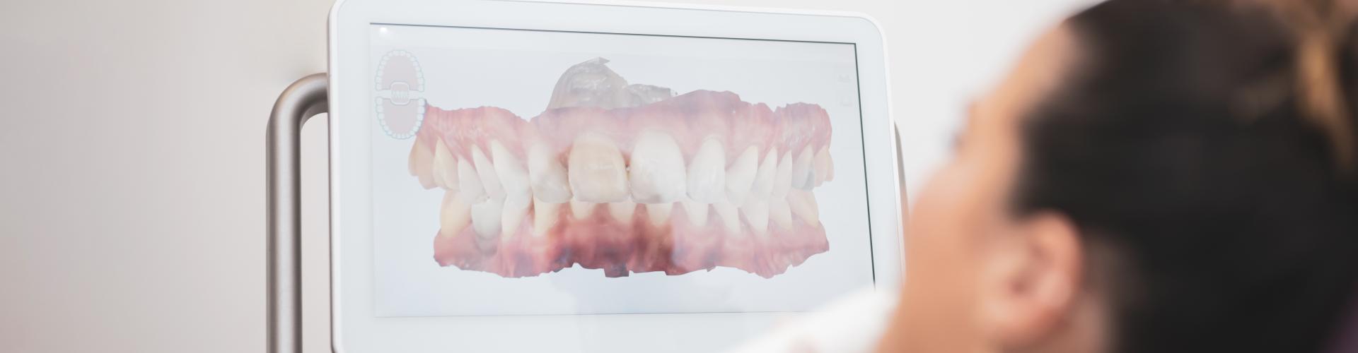 Digitális fogászat - a legmodernebb fogászati megoldások